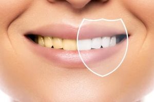 Nggak repot pakai charcoal, begini cara agar gigi minim plak dan noda kuning pakai 1 jenis rempah