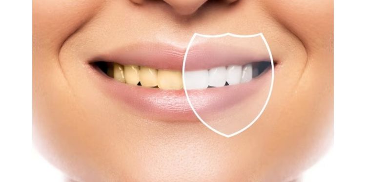 Nggak repot pakai charcoal, begini cara agar gigi minim plak dan noda kuning pakai 1 jenis rempah