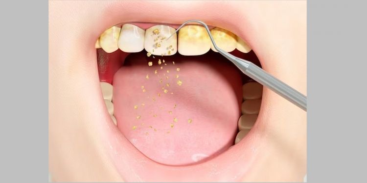 Tanpa garam atau lemon, begini cara bikin gigi putih berkilau cuma pakai 2 bahan dapur