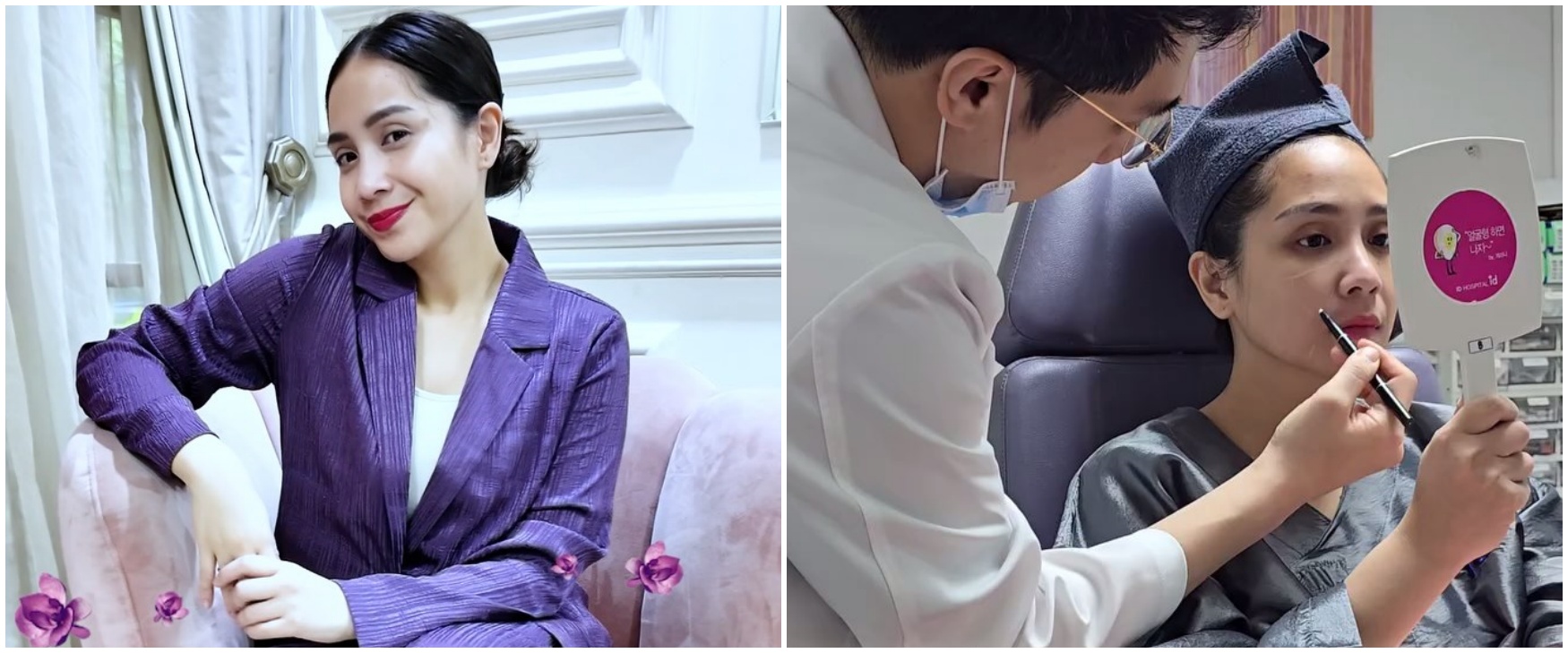 Nagita Slavina jalani perawatan kecantikan di Korea Selatan, kondisi wajahnya dikira operasi plastik