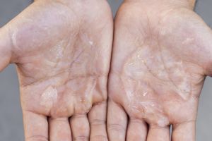 Tanpa kopi, begini cara menghaluskan telapak tangan kasar dan kering pakai 1 jenis pemanis