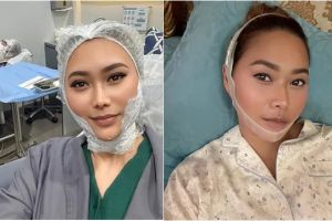 6 Potret Inul Daratista perawatan biar tirus dan awet muda bak ABG di usia 45, rutin pakai korset