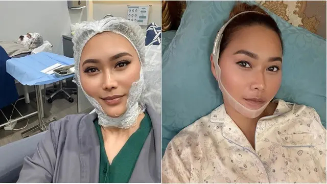 6 Potret Inul Daratista perawatan biar tirus dan awet muda bak ABG di usia 45, rutin pakai korset