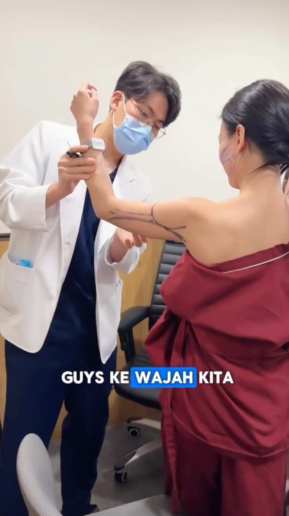 Sudah cantik tetap oplas, 9 potret Nita Gunawan jalani transfer lemak biar wajah tidak kempot