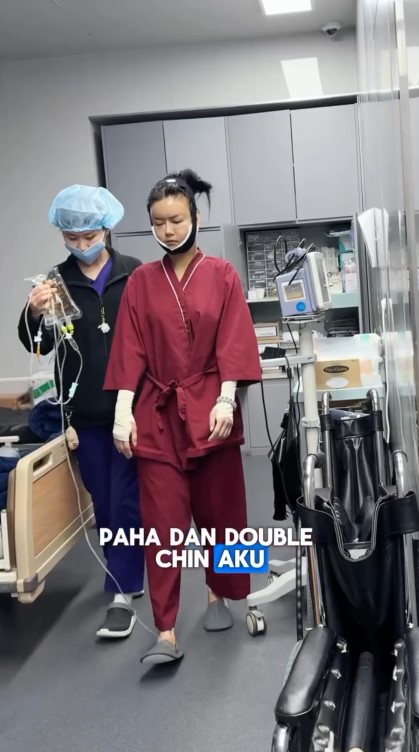 Sudah cantik tetap oplas, 9 potret Nita Gunawan jalani transfer lemak biar wajah tidak kempot