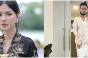 Sudah cantik tetap oplas, 9 potret Nita Gunawan jalani transfer lemak biar wajah tidak kempot