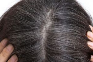 Bukan dicat hitam, begini trik agar uban tidak tumbuh lagi meski usia sudah 35 lebih