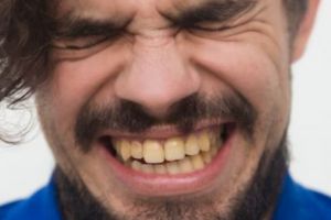 Cara menghilangkan noda kuning pada gigi dengan 1 jenis bumbu dapur, auto putih dalam 2 menit