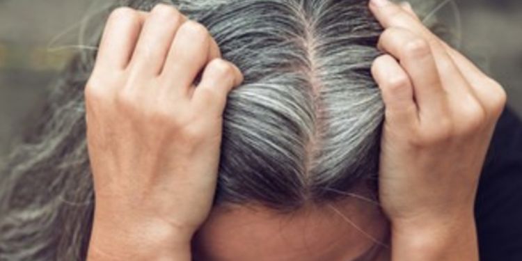 Trik mengatasi rambut beruban dengan 1 jenis buah-buahan, langsung hitam tanpa jintan