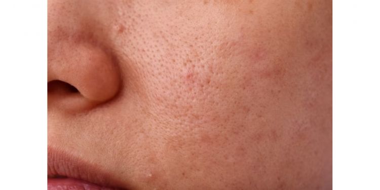 Bila Perlu Memudahkan Rutin Skincare