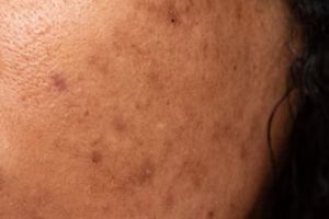 Cara memudarkan kerutan dan garis halus di wajah pakai 1 jenis umbi-umbian, auto mulus seketika