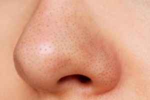 Cara bikin pori wajah mengecil dan bersih optimal dengan 1 jenis rempah, glowing dalam seminggu