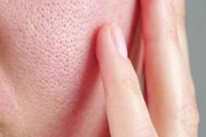 Cara atasi pori-pori besar di wajah pakai 1 kulit buah, halus tanpa madu