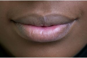 Cara hilangkan bibir hitam supaya lebih cerah dan tak pecah-pecah, cukup gunakan 2 bahan minuman ini