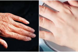 Cara menghilangkan keriput di tangan agar tampak kencang dan mulus, nggak usah repot pakai lotion