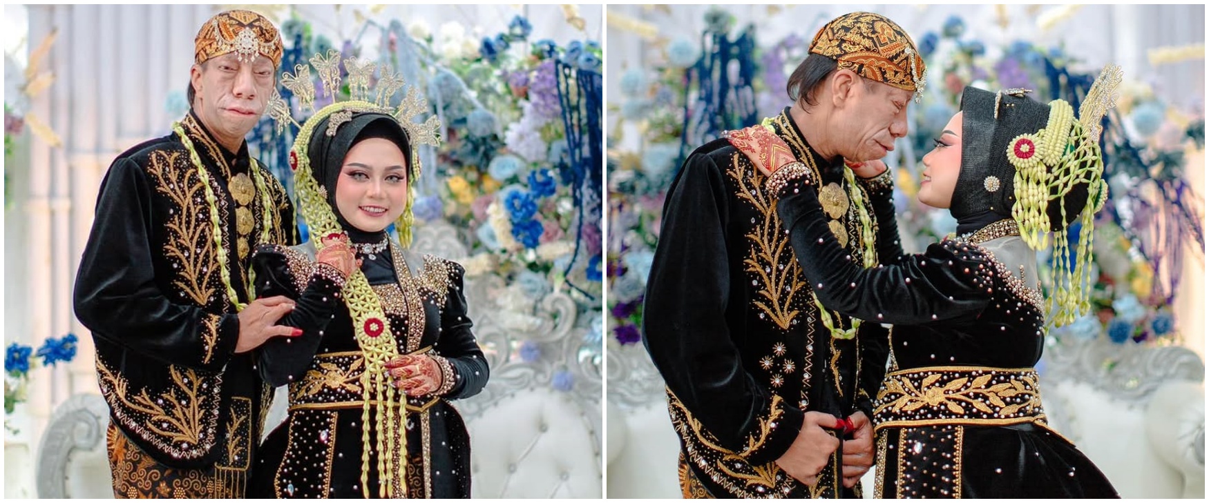 Ingat Surya Manurung pengidap sindrom langka? Kini gelar pesta nikah selang 2 tahun akad, 9 potretnya