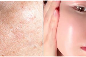 Cara mengecilkan pori-pori ini bikin wajah mulus dan bersih cuma dengan serum dari 1 ampas dapur