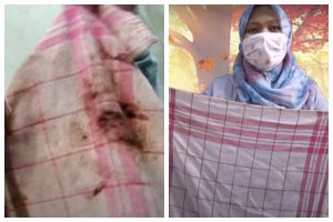 Cara cepat bersihkan kain serbet dapur kumal dekil kotor pakai 1 bahan dapur, cuma modal Rp 1.000