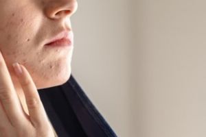 Cara bikin pori-pori mengecil agar kulit tampak mulus cuma dengan 1 kulit buah, bukan pakai bubuk kopi