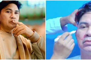 9 Momen Ronny Sianturi jalani oplas agar tampak awet muda, jadi kado diri sendiri di usia 60 tahun