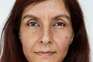 Cara cerahkan flek hitam di wajah akibat sinar matahari pakai 1 jenis daun, bukan pakai masker kunyit