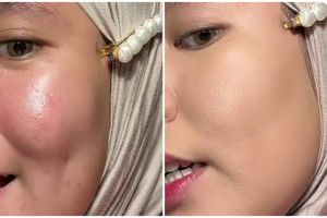 Punya pori-pori besar? Ini trik pakai foundation agar makeup lebih halus dan complexion tak luntur