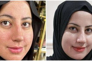 Pernah punya wajah bopeng, ini cara Tasyi Athasyia bikin kulit mulus lagi cuma dalam 1 bulan