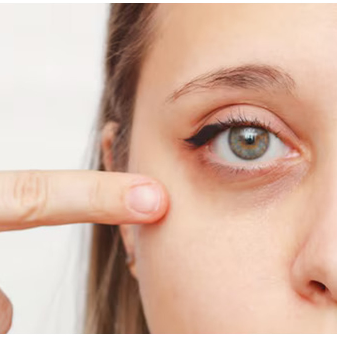 Tak perlu beli produk skincare, cara atasi kantung mata kendur dan hitam cuma dengan 3 bahan dapur