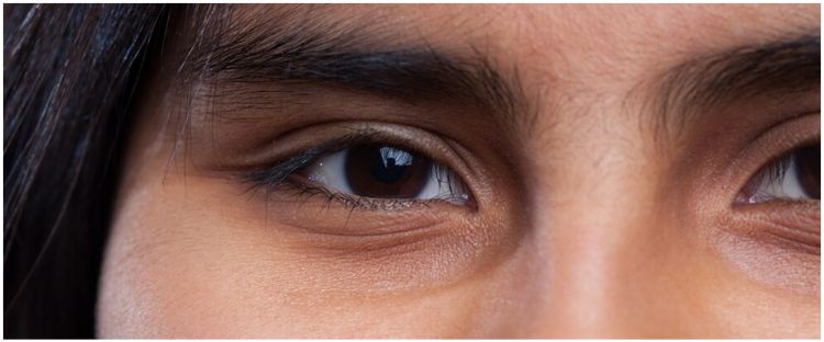 Cara mudah dan alami menghilangkan mata panda ini bantu samarkan garis halus meski tanpa eye cream