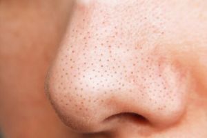 Cara menghaluskan tekstur kulit akibat pori-pori besar pakai 1 jenis lalapan, bukan pakai garam