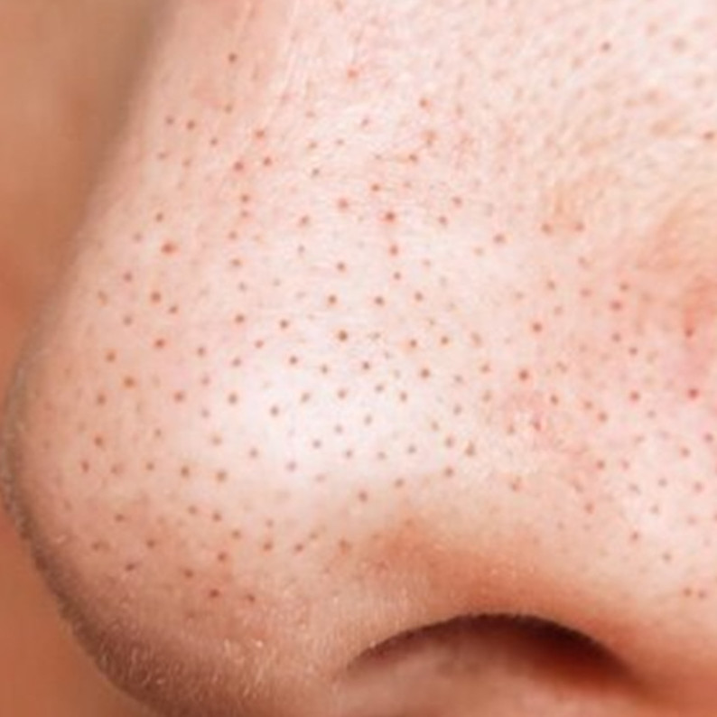 Cara menghaluskan tekstur kulit akibat pori-pori besar pakai 1 jenis lalapan, bukan pakai garam