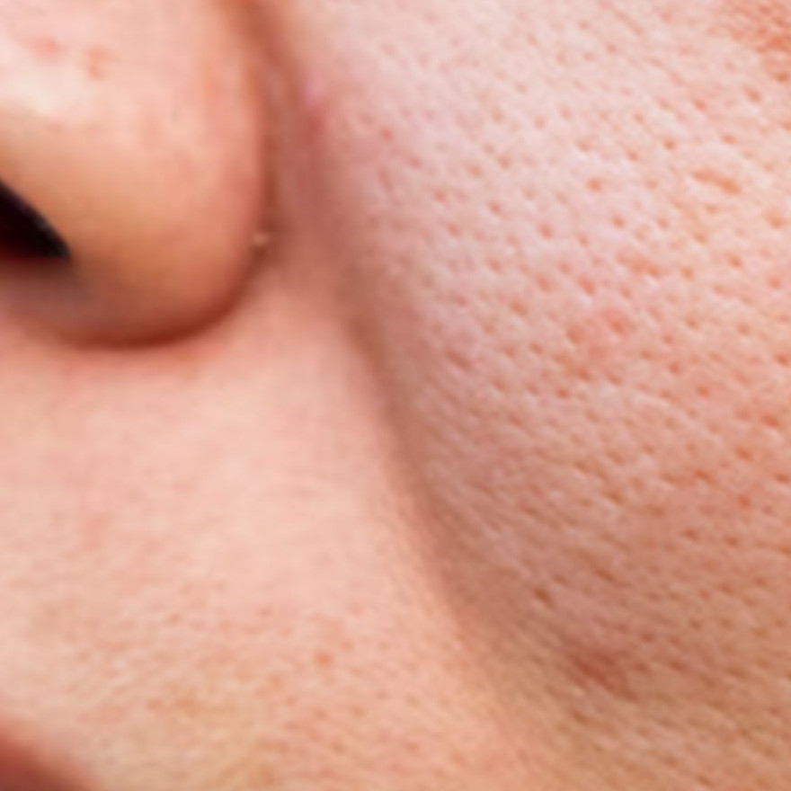 Cara merapatkan pori-pori agar wajah auto mulus pakai 1 bahan dapur, hasilnya auto tampak dalam 7 hari