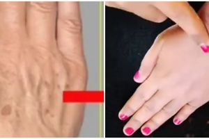 Kulit tangan tampak tua karena keriput dan kering? Ini cara mengatasinya cuma dengan 1 bahan minuman