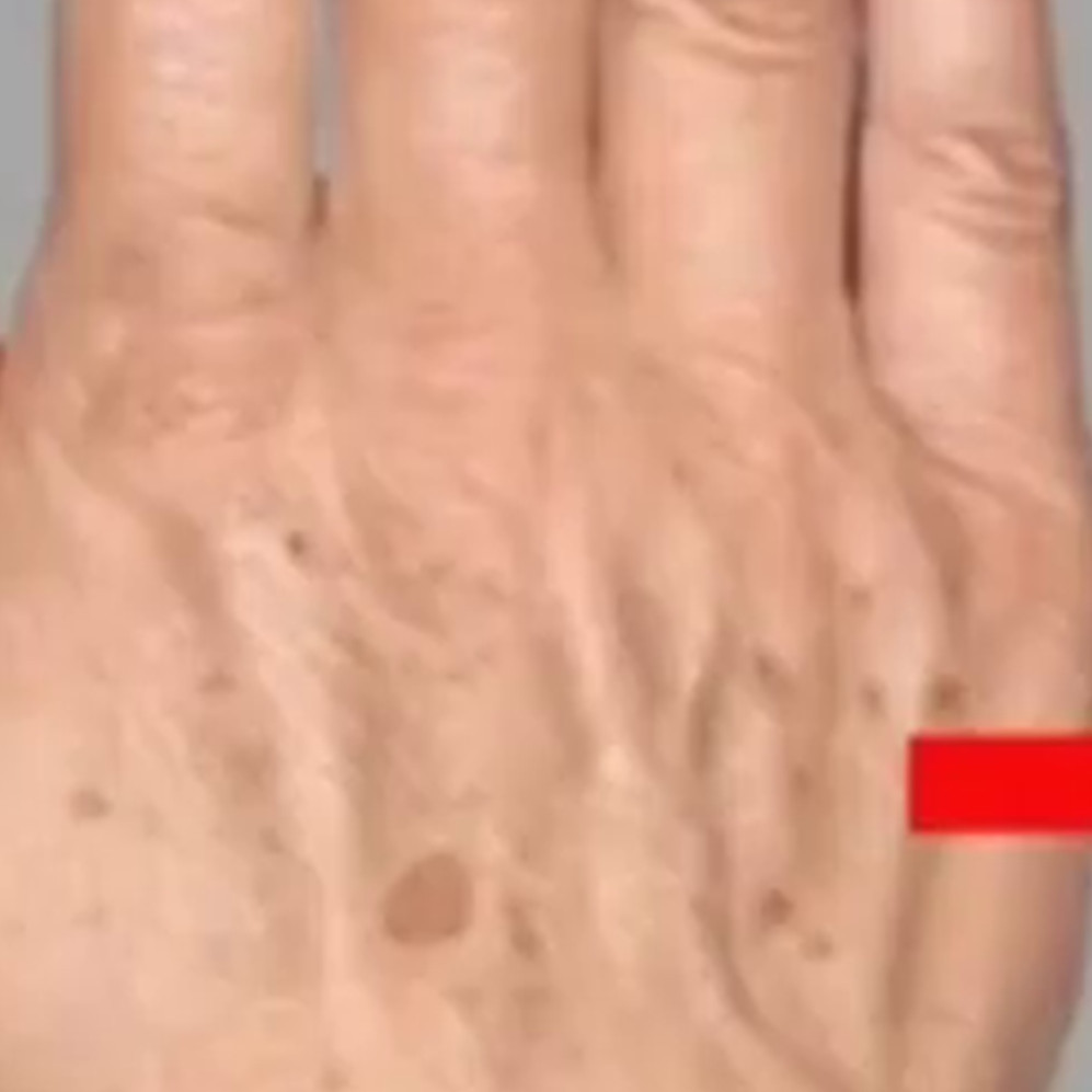 Kulit tangan tampak tua karena keriput dan kering? Ini cara mengatasinya cuma dengan 1 bahan minuman