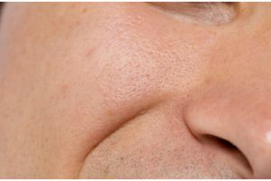 Kulit auto mulus, cara mengecilkan pori-pori besar ini bikin wajah bersih bebas kotoran dan minyak