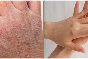 Tanpa lotion atau hand cream, ini trik kencangkan kulit tangan keriput dan kerutan agar mulus lagi
