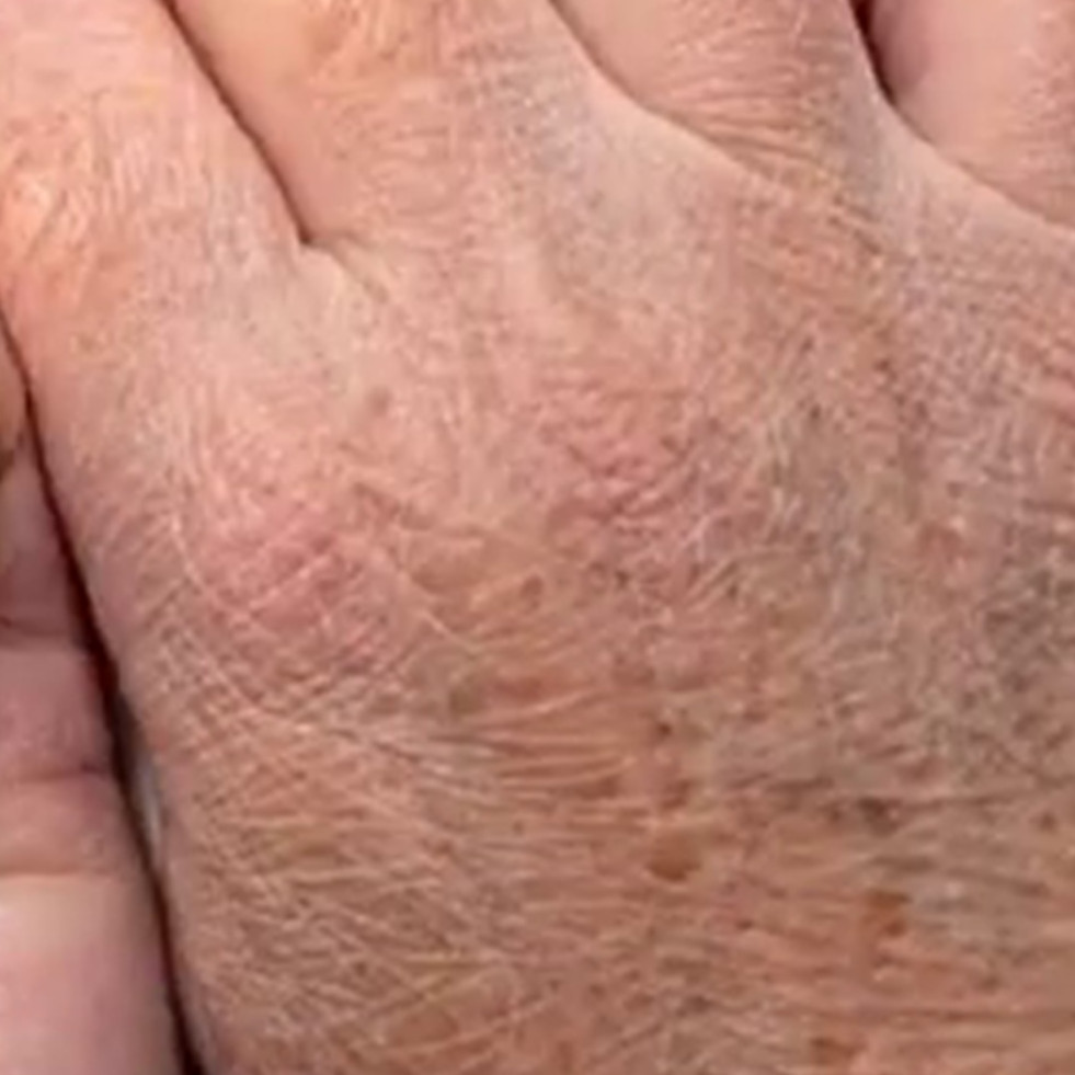 Tanpa lotion atau hand cream, ini trik kencangkan kulit tangan keriput dan kerutan agar mulus lagi