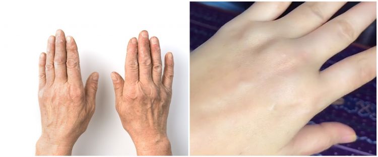 Cara atasi kulit tangan kering dan keriput ini bikin kencang, butuh minyak kelapa dan 3 bahan dapur