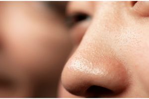 Cara ampuh hempaskan komedo hitam ini auto bersih dalam hitungan menit cuma dengan 2 bahan dapur