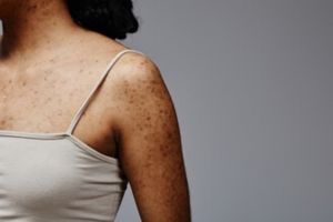 Cara rontokkan daki badan tanpa sisa pakai 1 jenis ampas minuman, bisa sekalian jaga lingkungan