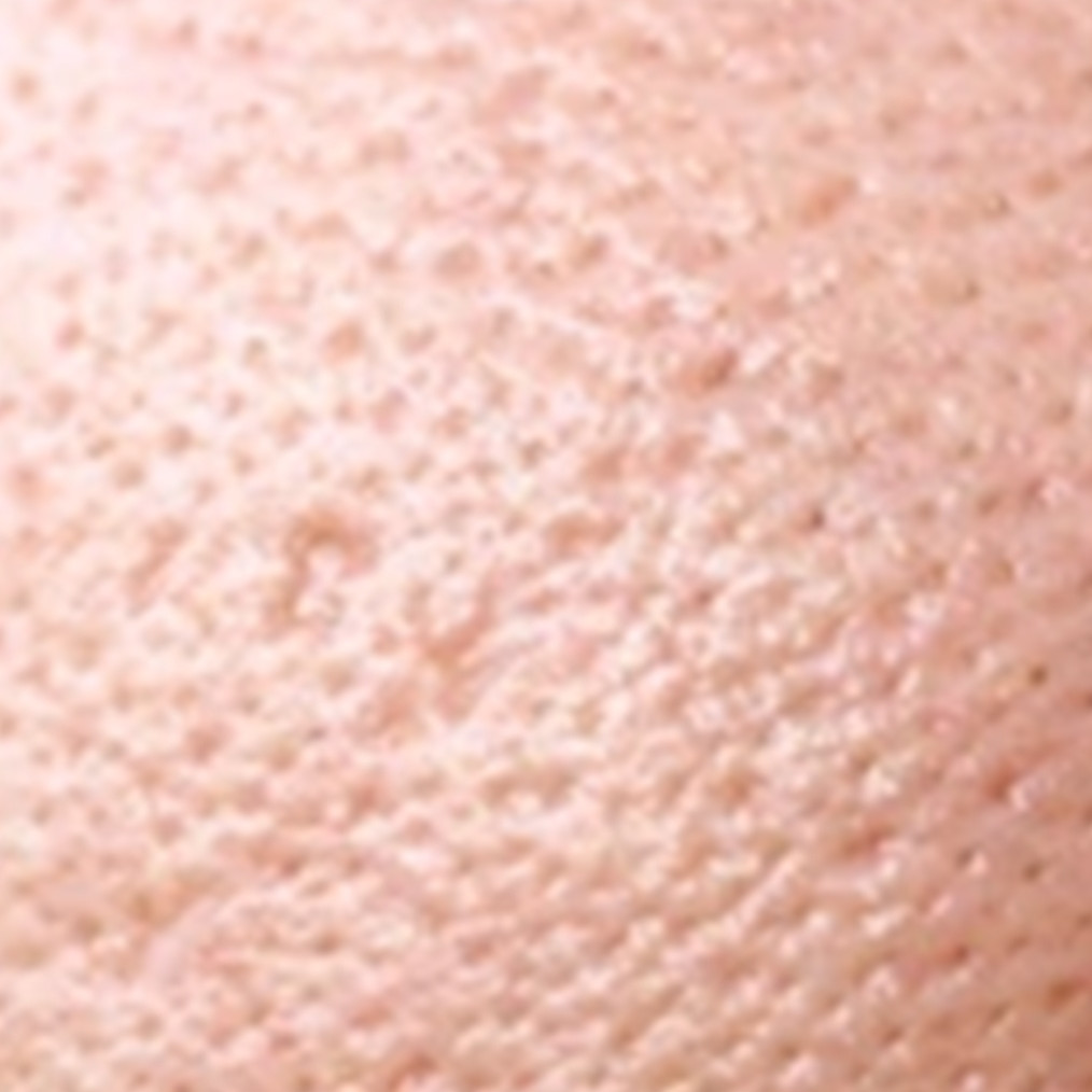 Wajah mulus dan bening tanpa skincare, ini cara alami mengecilkan pori-pori pakai 1 bahan pemanis