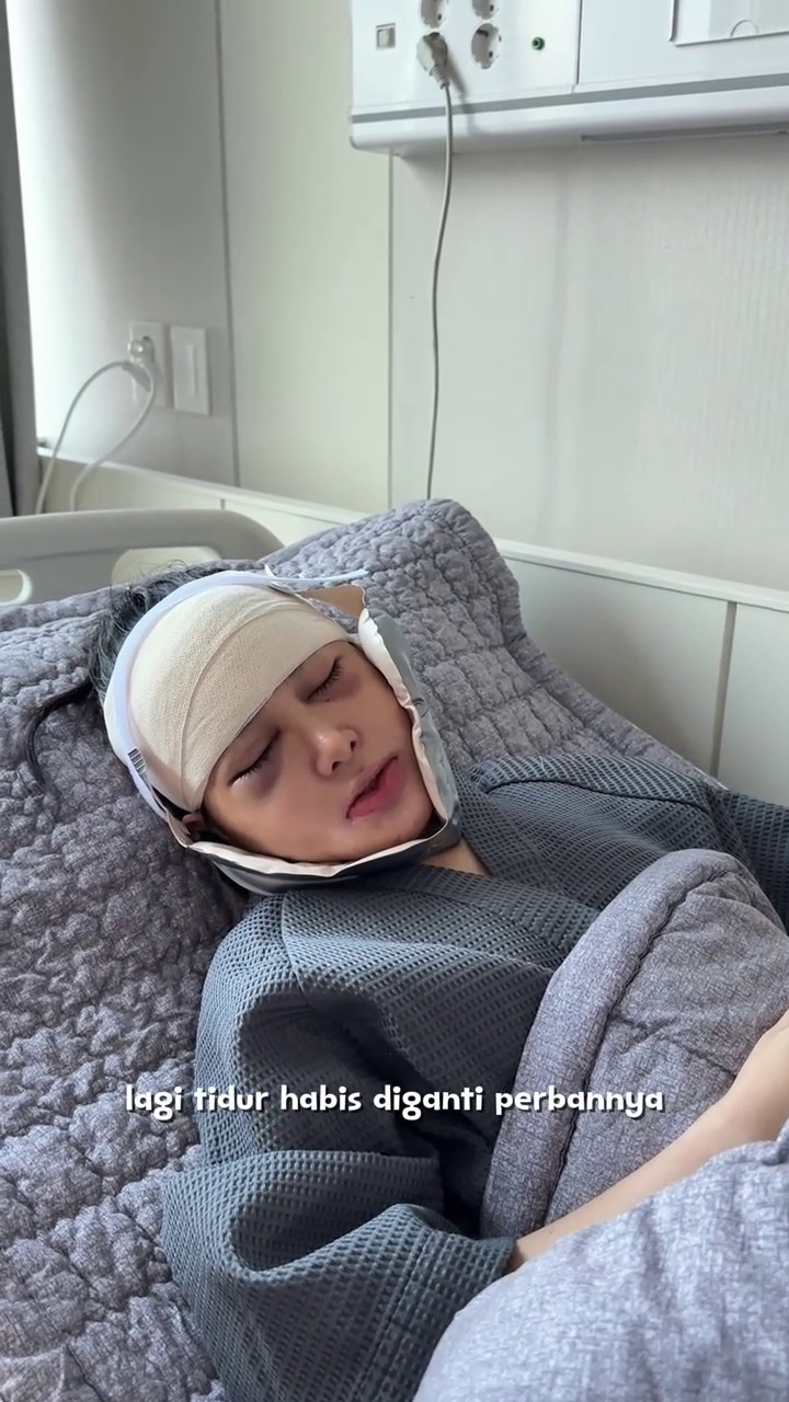 9 Potret Dilan jalani operasi plastik usai diselingkuhi suami, warganet ungkap kekecewaan