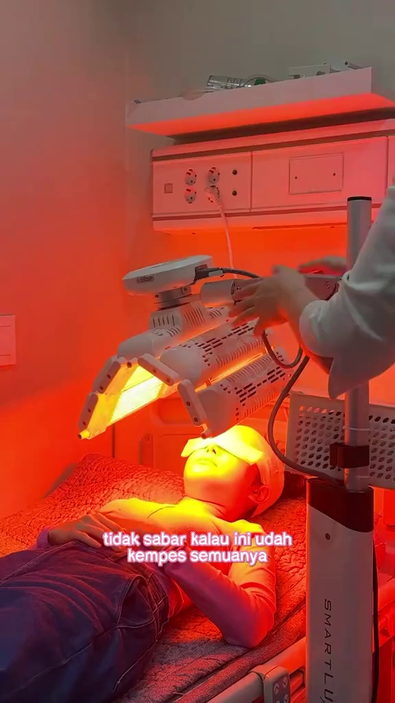 9 Potret Dilan jalani operasi plastik usai diselingkuhi suami, warganet ungkap kekecewaan