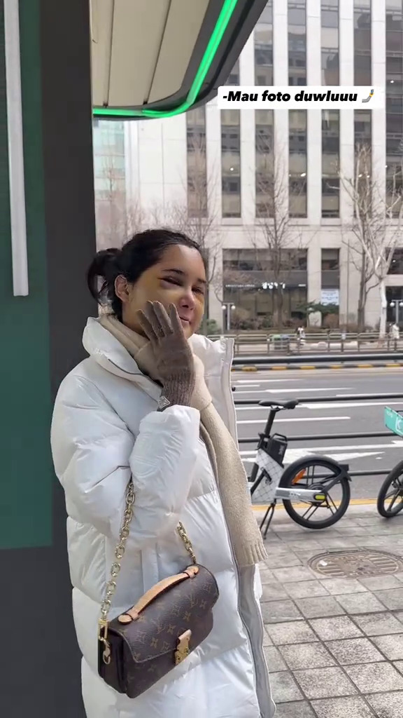 9 Potret Dilan jalani operasi plastik usai diselingkuhi suami, warganet ungkap kekecewaan