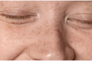 Kulit glowing tanpa retinol, ini cara hilangkan kerutan dan flek hitam di wajah pakai 1 jenis protein