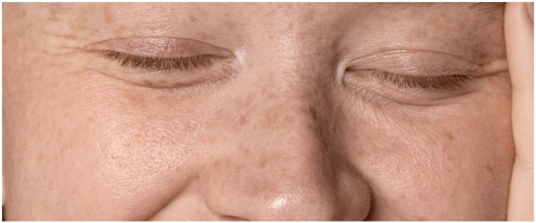 Kulit glowing tanpa retinol, ini cara hilangkan kerutan dan flek hitam di wajah pakai 1 jenis protein