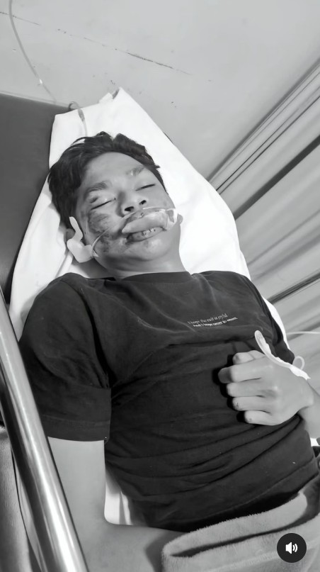 Ingat David Ozora korban penganiayaan Mario Dandy? Intip kabar terbarunya yang kini jadi santri