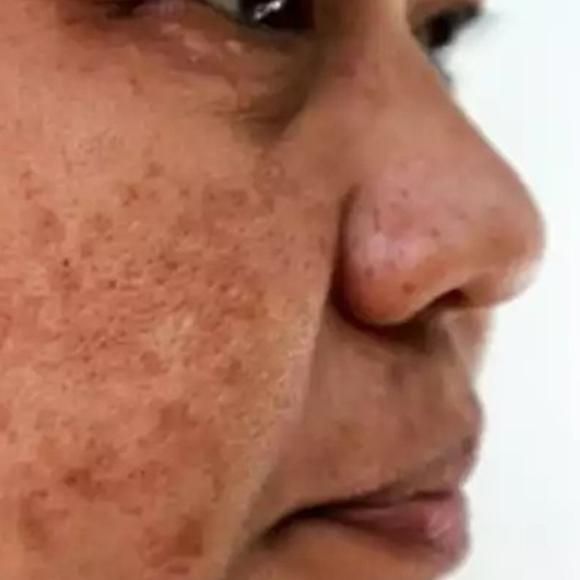 Trik mencerahkan wajah kusam hanya pakai masker dari bahan dapur, auto glowing dalam 3 hari