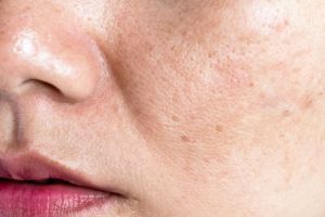 Trik mencerahkan kulit kusam hanya pakai 1 jenis biji-bijian, tak perlu beli serum vitamin C