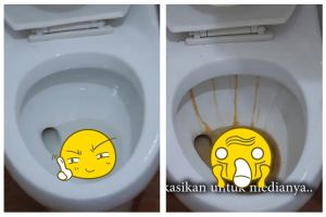 Trik menghilangkan kerak membandel di kloset tanpa diamplas, cukup andalkan 2 bahan dapur